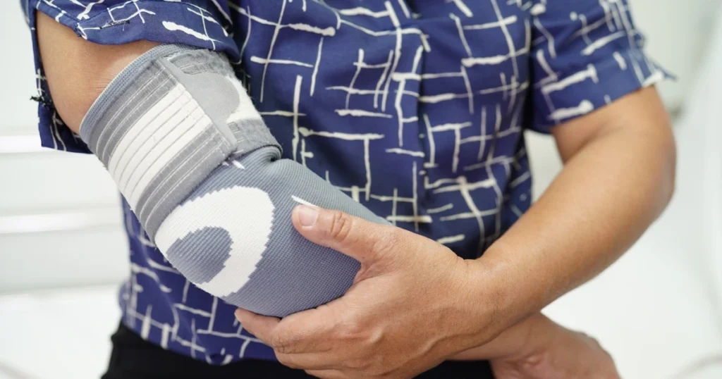 Someone with a cast on an arm.